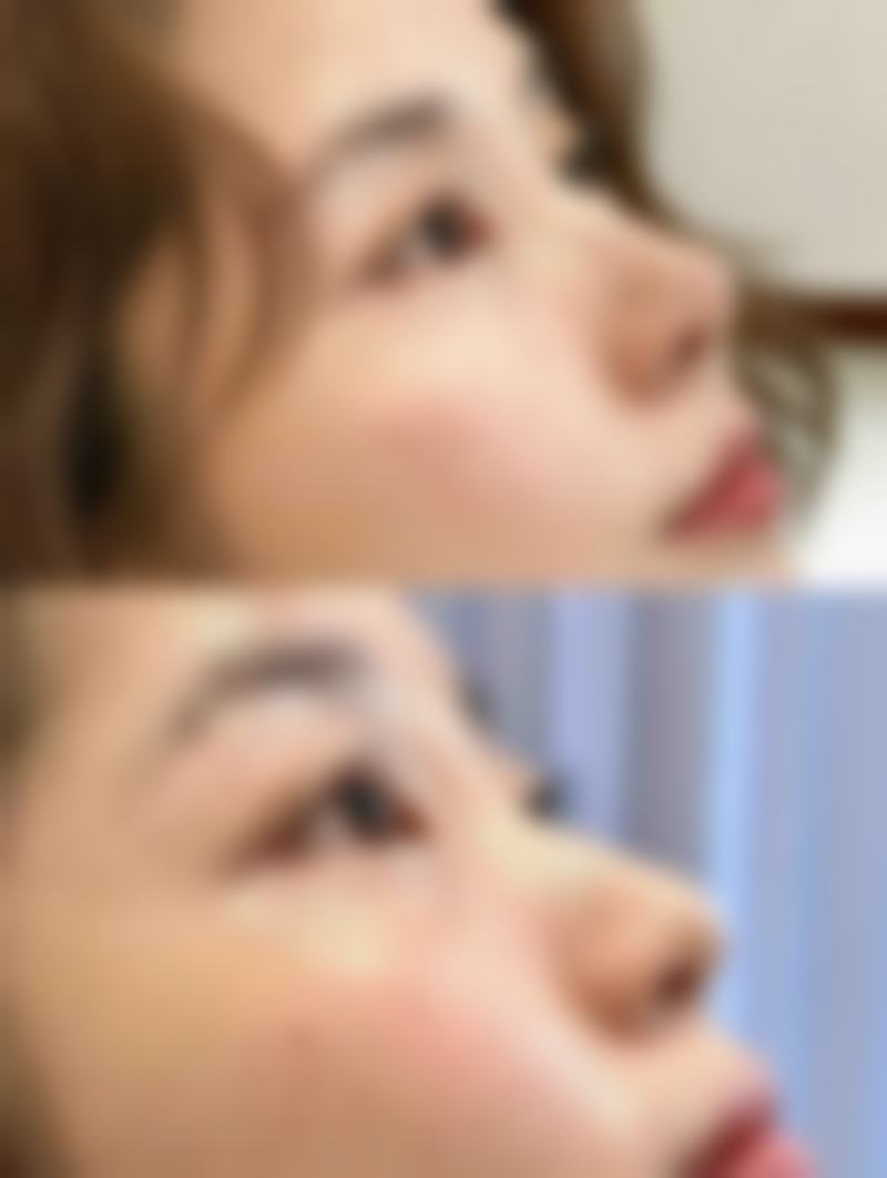 广州中山大学附属第一医院怎么样价格收费