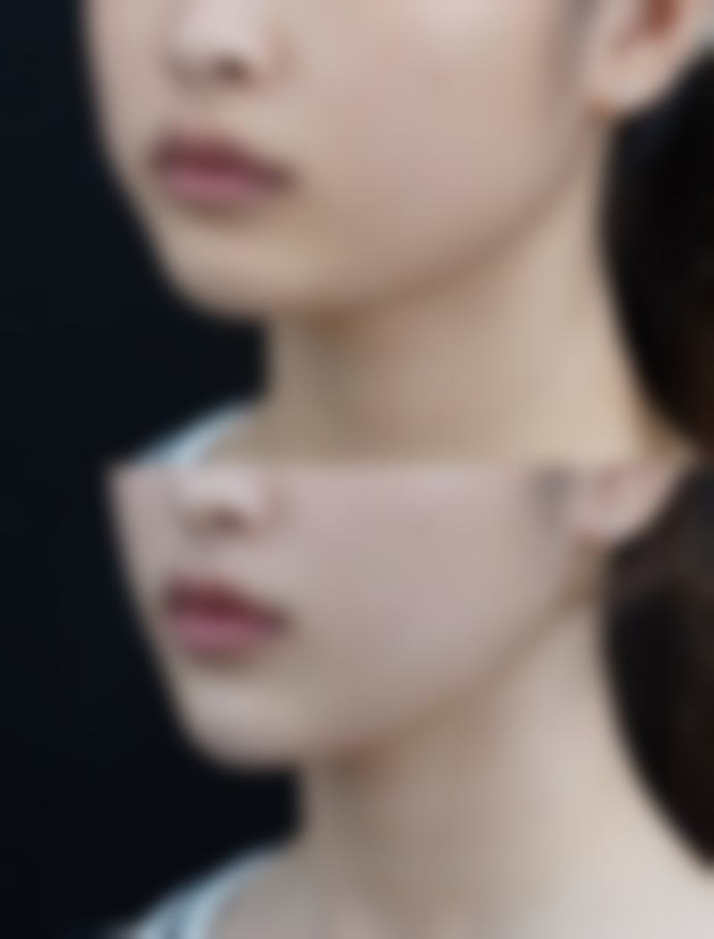 Rize Clinic 横滨怎么样特色项目及技术优势