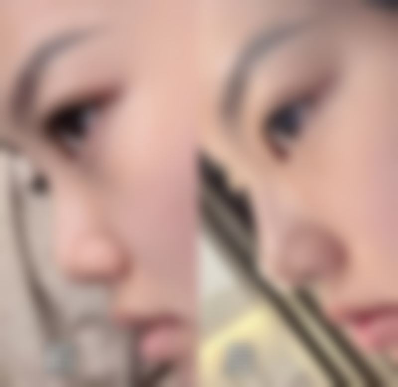 齐金杰医生的个性化整形理念