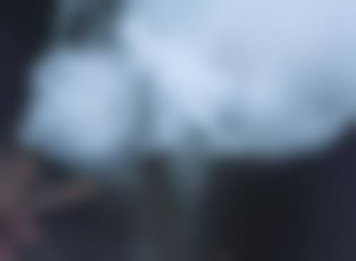 海口碧莲盛植发医院怎么样特色项目及技术优势