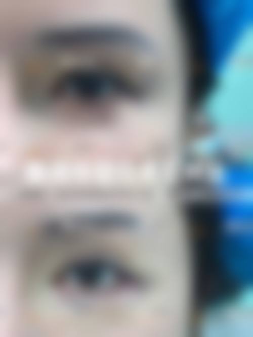 广州铂颜医疗美容门诊部怎么样求美者反馈