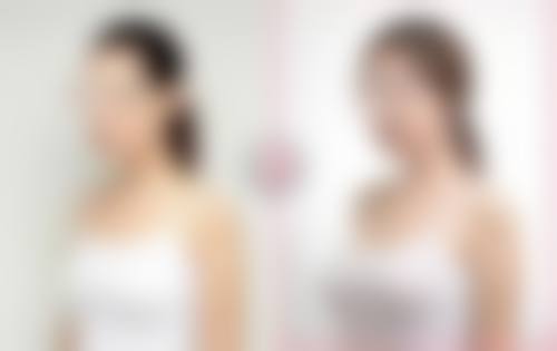 张家口国内人民解放军251医院整形美容科怎么样简介概述