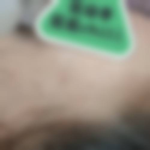 黄艳红医生:注射美容的专精之选