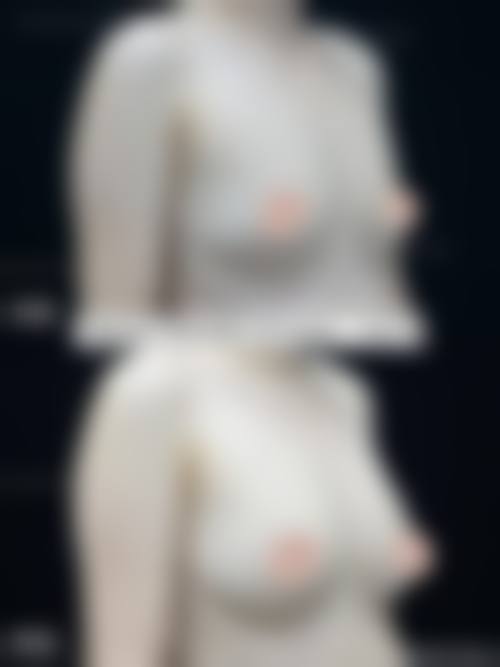 北京润美玉之光医疗美容(微整注射)怎么样来院路线