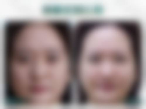 北京长岛医院怎么样求美者反馈