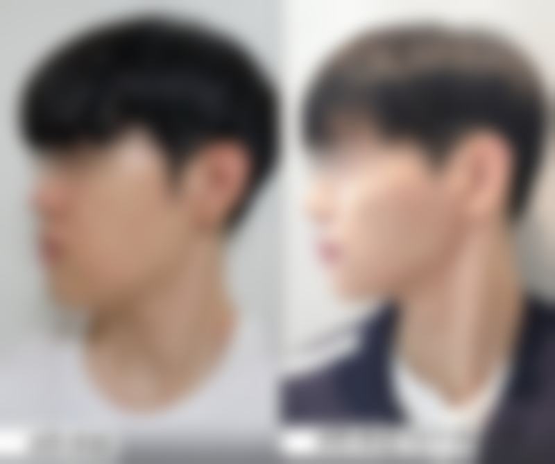 北京润美玉之光医疗美容(微整注射)怎么样求美者反馈