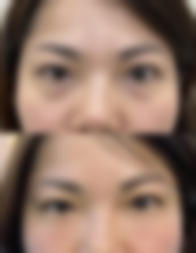 丁娓娓医生的成功实例