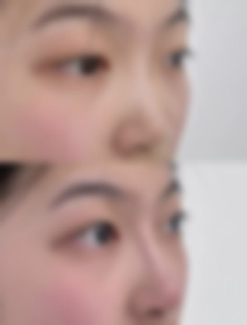 广州英妮芮医疗美容诊所怎么样医生团队实力