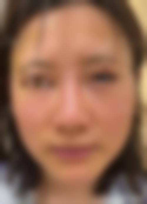 内蒙古格莱美大韩医学美容整形医院怎么样价格收费