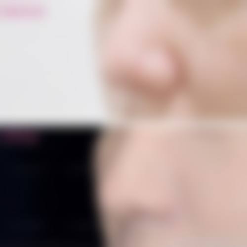 北京宫国华医美诊所怎么样求美者反馈