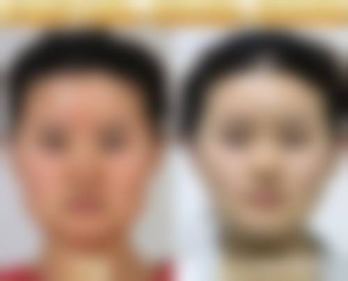 金坛市人民医院整形外科怎么样价格收费