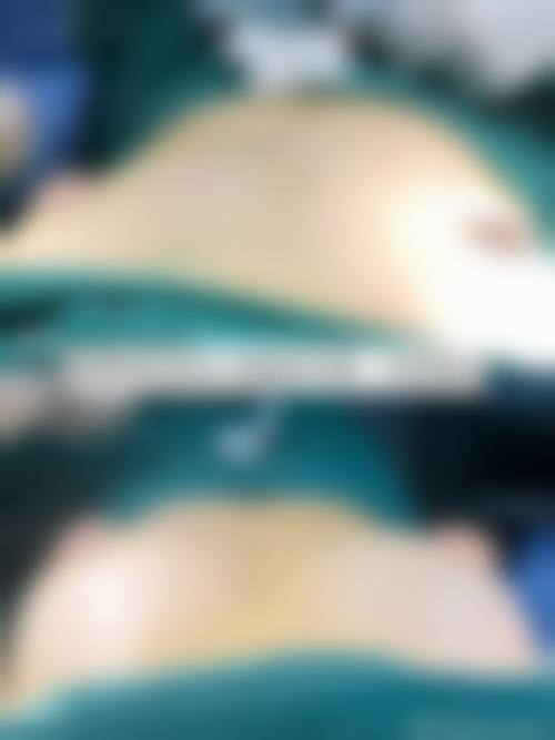 邢台臻悦医疗美容门诊部怎么样价格收费