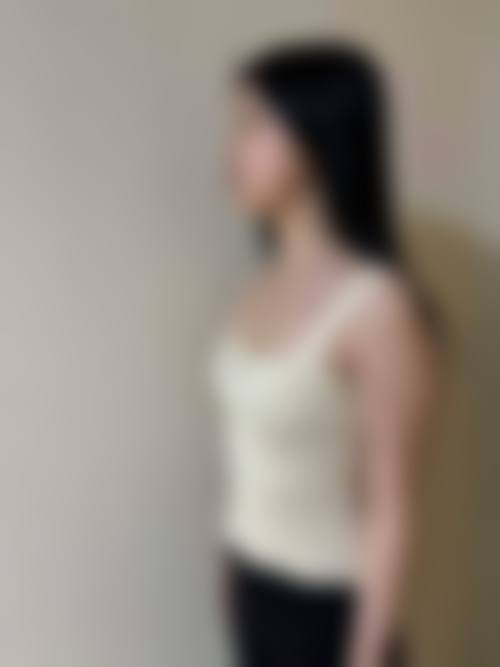 邢台臻悦医疗美容门诊部怎么样求美者反馈