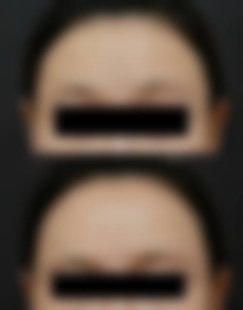 吉林市王泉祥医疗美容机构怎么样价格收费