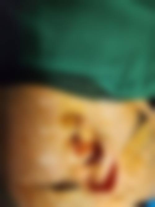 内蒙古格莱美大韩医学美容整形医院怎么样特色项目及技术优势