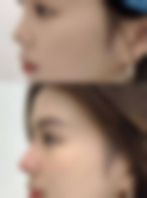 李芸医生的特殊优势技术