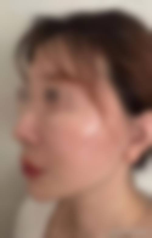 汕头曙光医疗美容怎么样价格收费