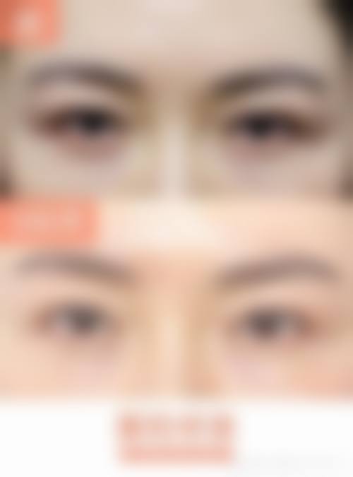 韩国江南琼june整形外科怎么样简介概述