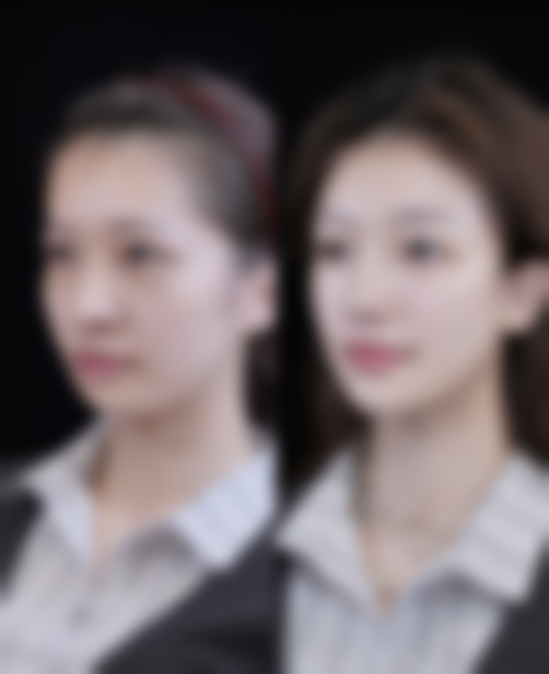 金坛市人民医院整形外科怎么样求美者反馈