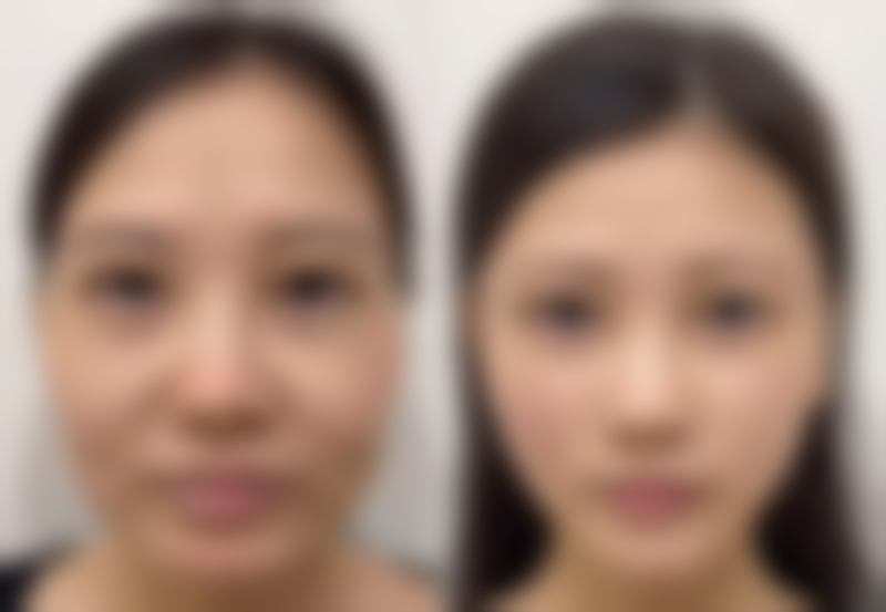 金坛市人民医院整形外科怎么样来院路线