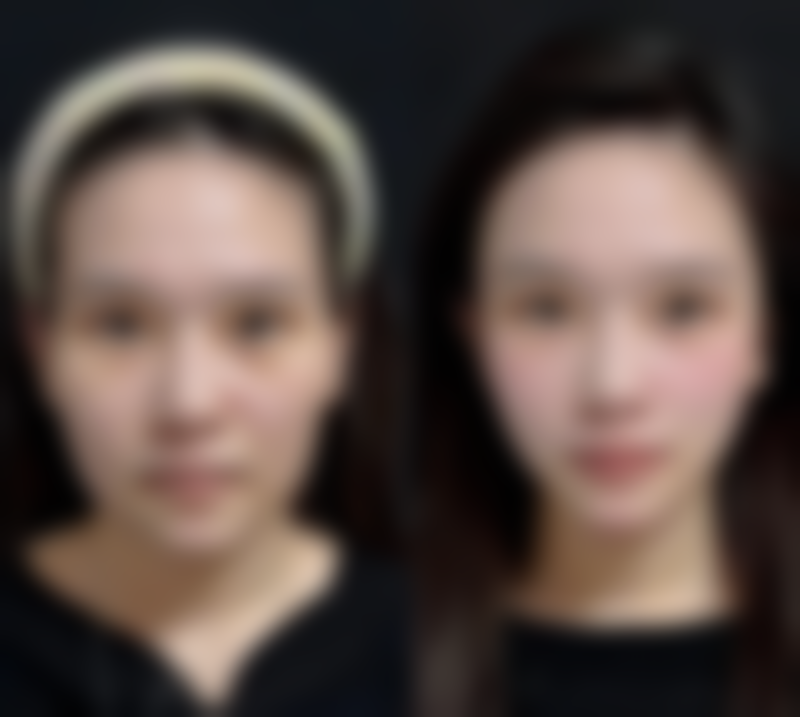 王海燕医生的价格与方案