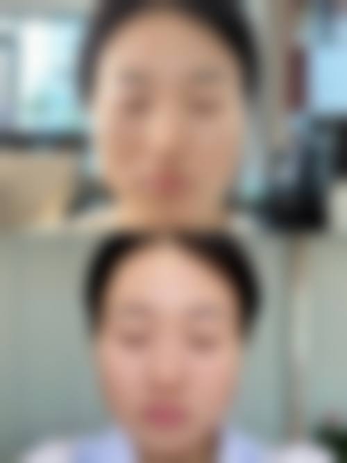 南宁维密医疗美容整形怎么样特色项目及技术优势