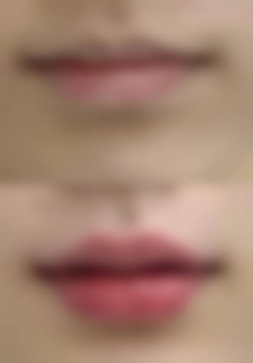 安阳仁济医院医疗美容科怎么样特色项目及技术优势