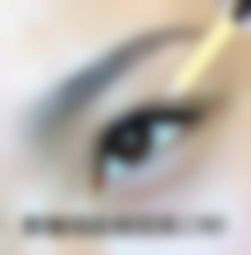 梁智辉医生的技术特色