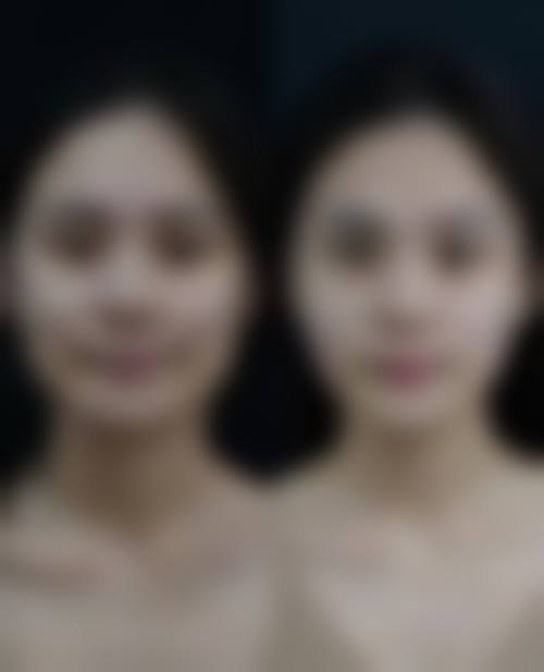 深圳金美人整形美容医院怎么样求美者反馈