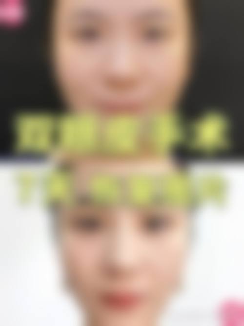 上海诺迪新天地美容门诊部怎么样求美者反馈