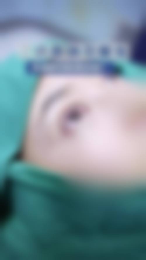 青海澳丽医疗美容整形减肥中 心怎么样求美者反馈