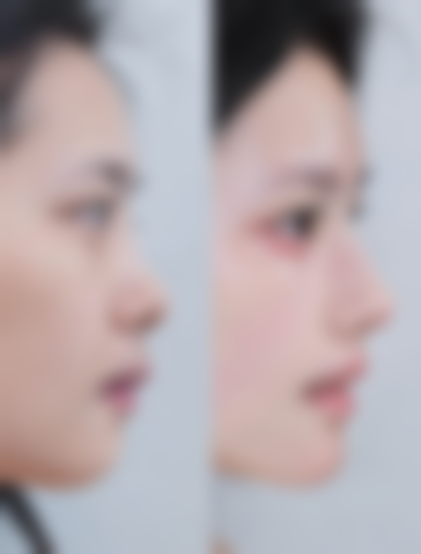 深圳美加美医疗美容医院怎么样特色项目及技术优势