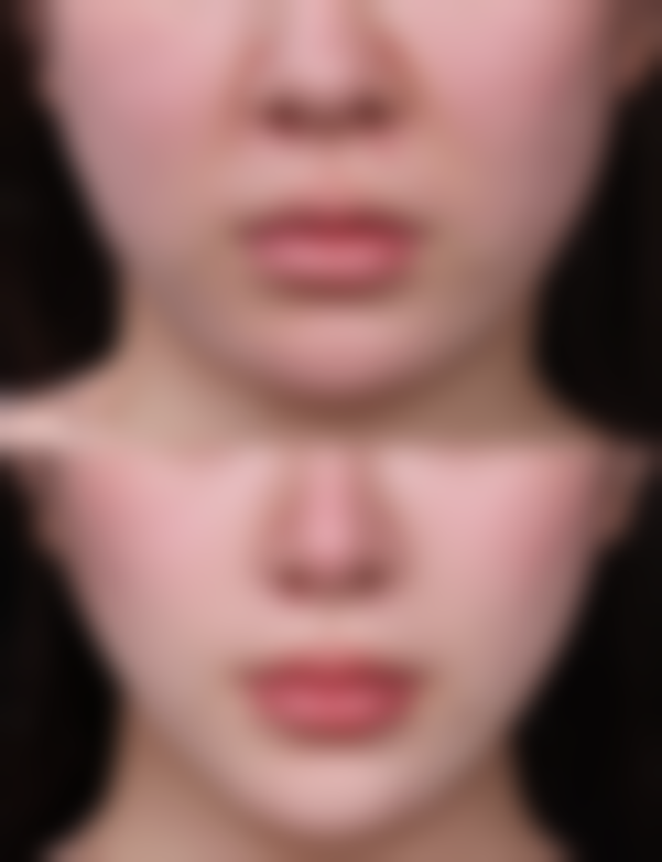 陈咸伸医生的成功实例见证实力