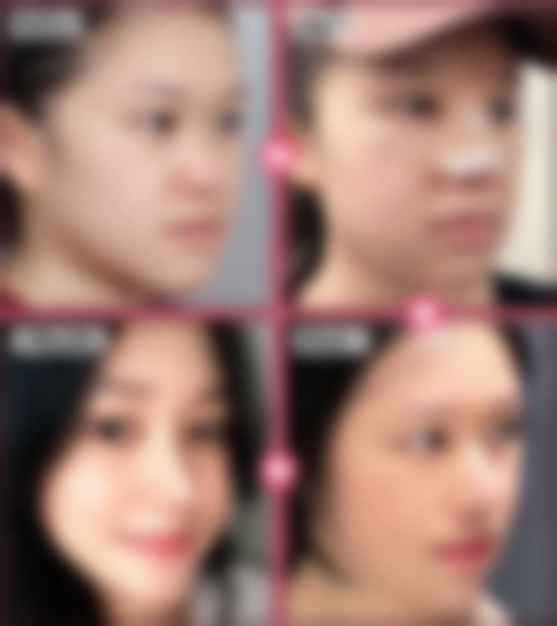 深圳美加美医疗美容医院怎么样求美者反馈