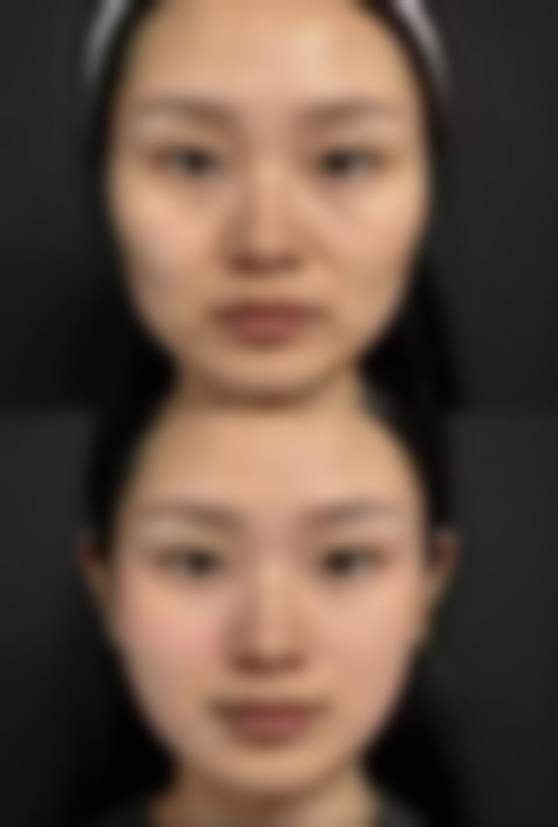 南宁维密医疗美容整形怎么样求美者反馈