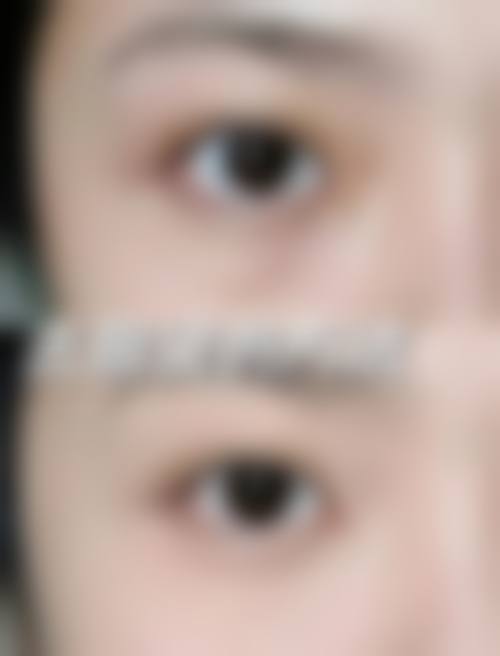 南京溧阳茶亭医院皮肤美容科怎么样来院路线