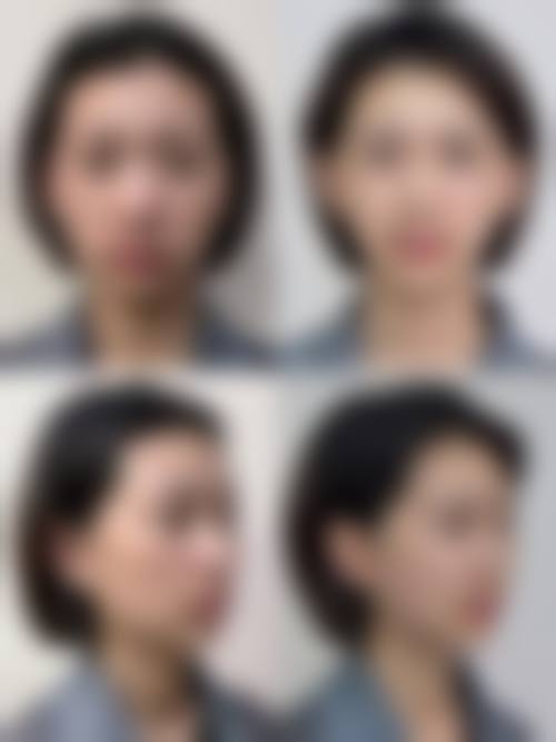 延吉韩雅医学美容诊所怎么样求美者反馈