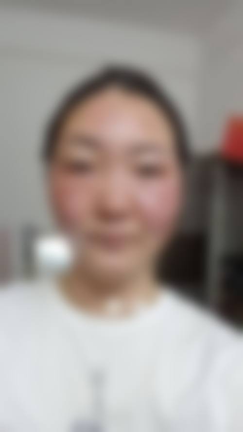 绍兴上虞市皮肤病防治医院整形科怎么样价格收费