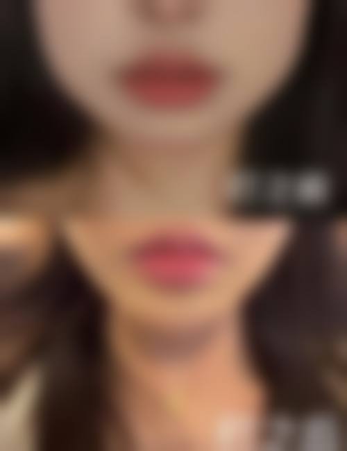 长沙丽臻医疗美容医院怎么样简介概述