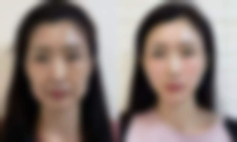 秦雷医生的贴心术后关怀