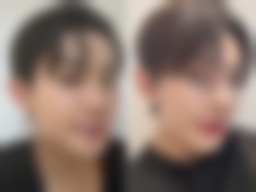 延吉韩雅医学美容诊所怎么样价格收费