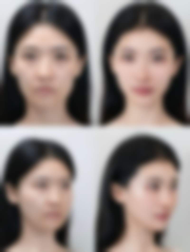 湖北武汉武总医疗美容诊所怎么样求美者反馈