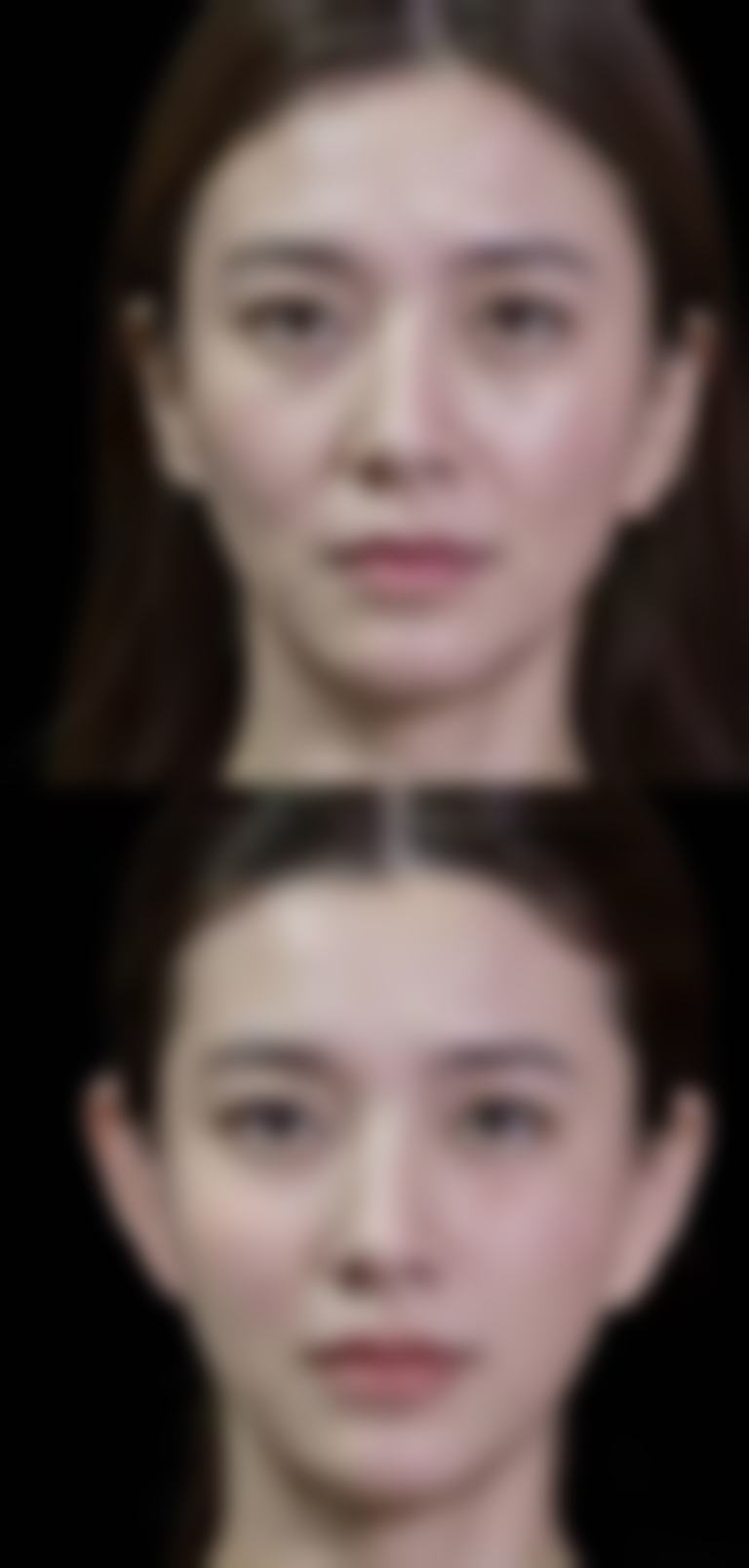 广安愈美整形医院怎么样求美者反馈