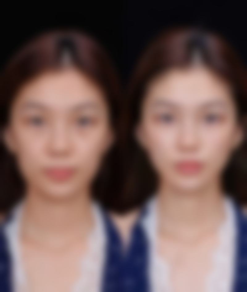 保定佰兰医疗美容门诊部怎么样价格收费