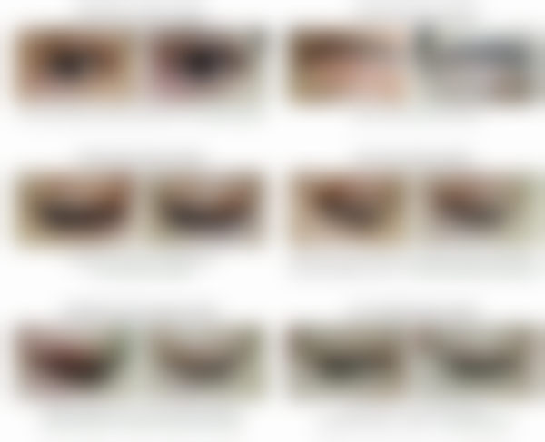 韩国思亲肤乐疤痕管理中 心怎么样价格收费