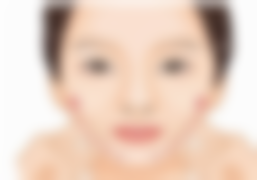 徐小辉带来的美丽蜕变实例