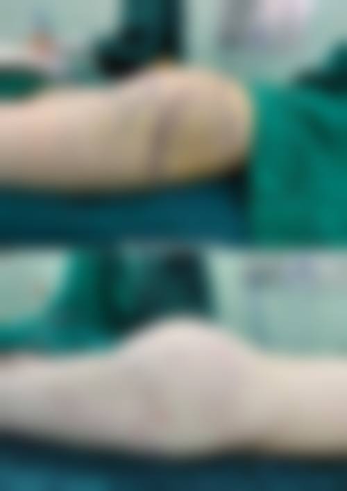 河南南阳市中心医院整形美容科怎么样医生团队实力