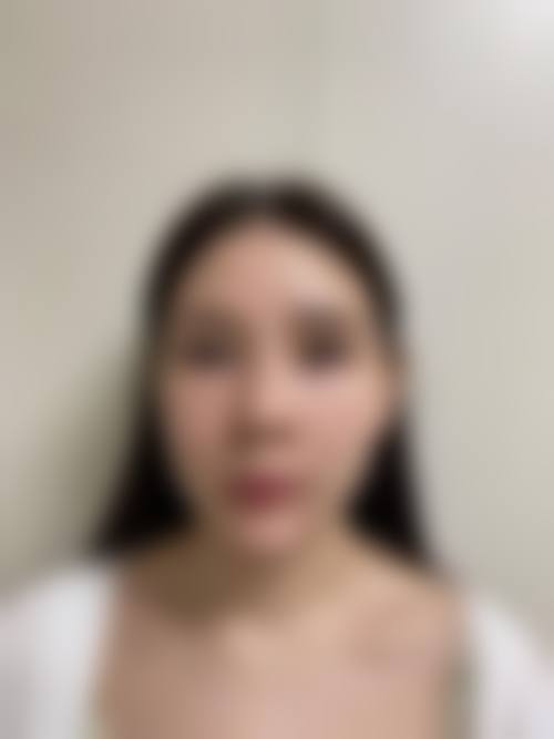 韩国JUM口腔颌面外科医院怎么样求美者反馈