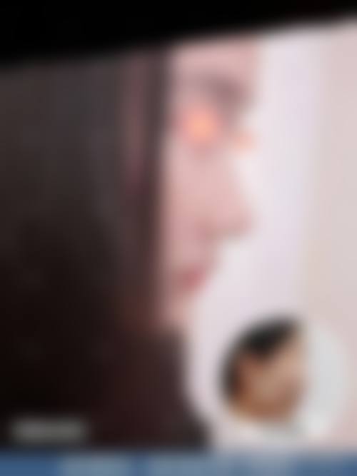 韩国JUM口腔颌面外科医院怎么样来院路线