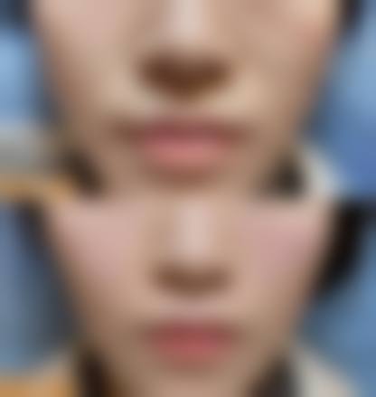 沈阳铁西金精华医疗美容诊所怎么样价格收费